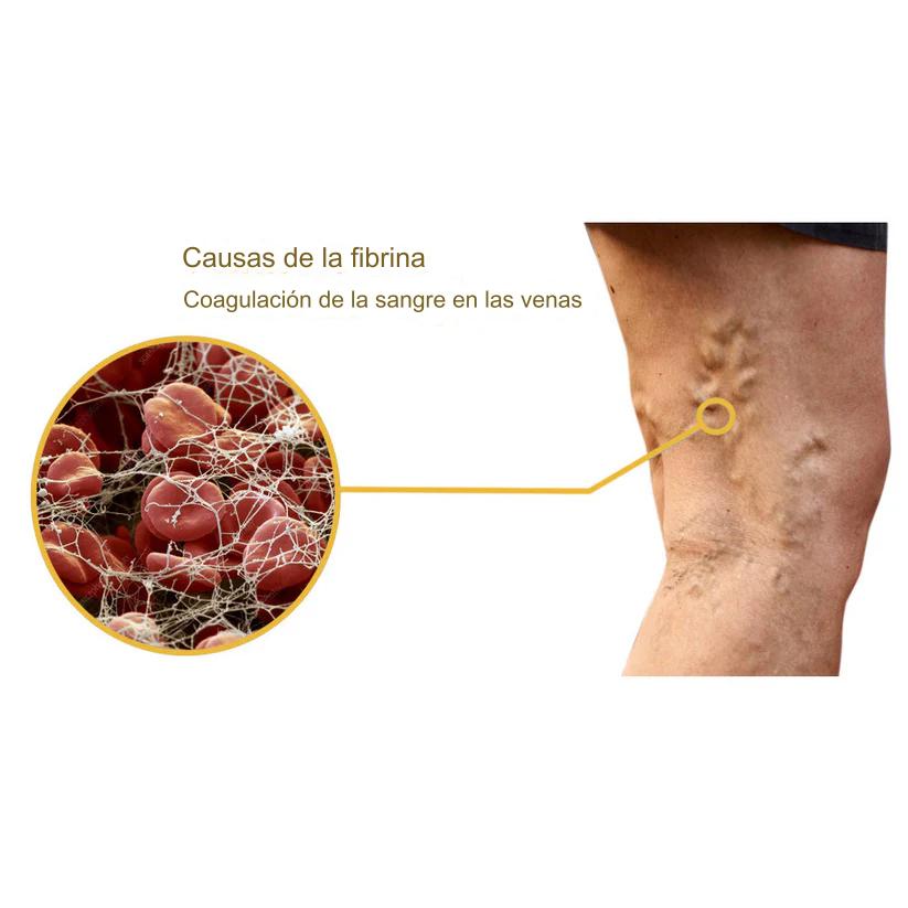 BEEVENOM 2X1 🐝 VARICOX VEINⓇ Veneno de abeja contra la VARICE + ULCERA + FLEBITIS