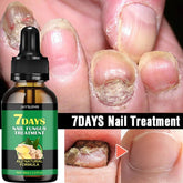 🎁 (Lleva 2 x 1) 🎁Nail Treatment - Tratamiento de hongos para las uñas