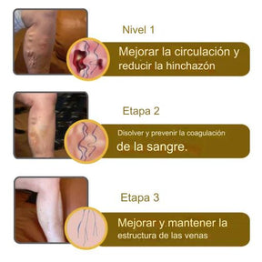 BEEVENOM 2X1 🐝 VARICOX VEINⓇ Veneno de abeja contra la VARICE + ULCERA + FLEBITIS